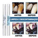 Pet Clean Pen: Caneta de limpeza dental fácil e rápida para pets